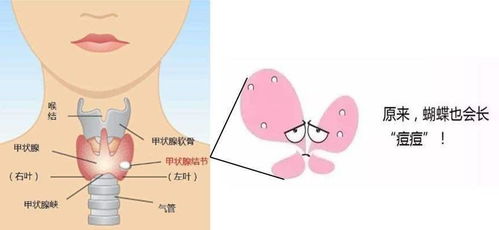 甲状腺功能,到底查五项还是七项